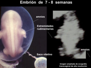 El uso del ultrasonido durante el embarazo